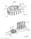Fig. 07 - Brush, in particular toothbrush, and associated production method
