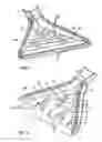 Fig. 03 - Application nozzle for viscous adhesives