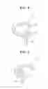 Fig. 05 - LOOSE PREVENTING ASSEMBLY