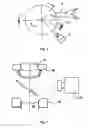Fig. 03 - Embossing method and apparatus