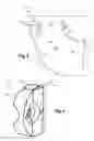 Fig. 05 - Exhaust hood diffuser