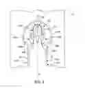 Fig. 04 - Blade-retaining device for turbomachine propeller