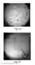 Fig. 45 - METHODS AND COMPOSITIONS FOR CELL-PROLIFERATION-RELATED DISORDERS
