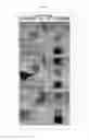 Fig. 09 - Biodegradable and thermosensitive poly(organophosphazene)-superparamagnetic nanoparticle complex, preparation method and use thereof
