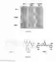 Fig. 23 - Compositions and methods for glucose transport inhibition