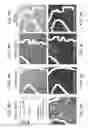 Fig. 16 - Programming of cells for tolerogenic therapies