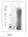 Fig. 04 - ANTI-MICROBIAL AGENT FROM PAENIBACILLUS SP. AND METHODS AND USES THEREOF