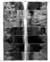 Fig. 01 - Pharmaceutical Composition For Bone Disease Treatment Or Countering Inflammation, Comprising Cartilage Stem Cells As An Active Principle