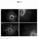 Fig. 04 - Pharmaceutical Composition For Bone Disease Treatment Or Countering Inflammation, Comprising Cartilage Stem Cells As An Active Principle