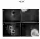 Fig. 05 - Pharmaceutical Composition For Bone Disease Treatment Or Countering Inflammation, Comprising Cartilage Stem Cells As An Active Principle
