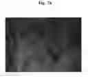 Fig. 06 - Pharmaceutical Composition For Bone Disease Treatment Or Countering Inflammation, Comprising Cartilage Stem Cells As An Active Principle