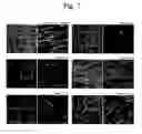 Fig. 20 - Pharmaceutical Composition For Bone Disease Treatment Or Countering Inflammation, Comprising Cartilage Stem Cells As An Active Principle