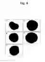 Fig. 21 - Pharmaceutical Composition For Bone Disease Treatment Or Countering Inflammation, Comprising Cartilage Stem Cells As An Active Principle