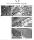 Fig. 23 - Pharmaceutical Composition For Bone Disease Treatment Or Countering Inflammation, Comprising Cartilage Stem Cells As An Active Principle