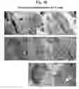 Fig. 25 - Pharmaceutical Composition For Bone Disease Treatment Or Countering Inflammation, Comprising Cartilage Stem Cells As An Active Principle