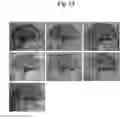 Fig. 30 - Pharmaceutical Composition For Bone Disease Treatment Or Countering Inflammation, Comprising Cartilage Stem Cells As An Active Principle
