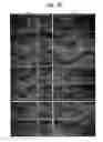 Fig. 32 - Pharmaceutical Composition For Bone Disease Treatment Or Countering Inflammation, Comprising Cartilage Stem Cells As An Active Principle