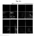 Fig. 33 - Pharmaceutical Composition For Bone Disease Treatment Or Countering Inflammation, Comprising Cartilage Stem Cells As An Active Principle