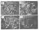 Fig. 01 - Compositions and Methods of Using Living and Non-Living Bioactive Devices with Components Derived From Self-Renewing Colony Forming Cells Cultured and Expanded In Vitro