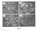 Fig. 03 - Compositions and Methods of Using Living and Non-Living Bioactive Devices with Components Derived From Self-Renewing Colony Forming Cells Cultured and Expanded In Vitro