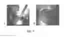 Fig. 10 - Compositions and Methods of Using Living and Non-Living Bioactive Devices with Components Derived From Self-Renewing Colony Forming Cells Cultured and Expanded In Vitro
