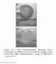 Fig. 62 - Compositions and Methods of Using Living and Non-Living Bioactive Devices with Components Derived From Self-Renewing Colony Forming Cells Cultured and Expanded In Vitro