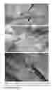 Fig. 63 - Compositions and Methods of Using Living and Non-Living Bioactive Devices with Components Derived From Self-Renewing Colony Forming Cells Cultured and Expanded In Vitro
