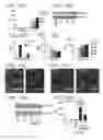 Fig. 11 - Methods of expanding and redifferentiating islet beta cells