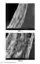 Fig. 05 - Ophthalmic solution for protecting internal structures of the eyeball against UV-A rays or for the treatment of keratoconus with a trans-epithelial cross-linking technique