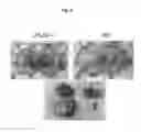 Fig. 05 - Lysosomal phospholipase A2 (LPLA2) activity as a therapeutic target for treating systemic lupus erythematosus