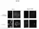 Fig. 07 - Lysosomal phospholipase A2 (LPLA2) activity as a therapeutic target for treating systemic lupus erythematosus