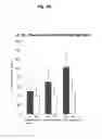 Fig. 08 - Lysosomal phospholipase A2 (LPLA2) activity as a therapeutic target for treating systemic lupus erythematosus
