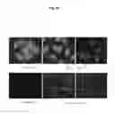 Fig. 09 - Lysosomal phospholipase A2 (LPLA2) activity as a therapeutic target for treating systemic lupus erythematosus