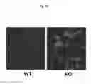 Fig. 10 - Lysosomal phospholipase A2 (LPLA2) activity as a therapeutic target for treating systemic lupus erythematosus