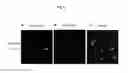 Fig. 11 - Lysosomal phospholipase A2 (LPLA2) activity as a therapeutic target for treating systemic lupus erythematosus