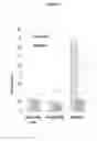 Fig. 03 - Antibodies to toxins
