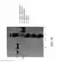 Fig. 15 - Soluble PD-1 variants, fusion constructs, and uses thereof