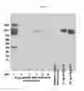Fig. 06 - Expression in plants of HIV-related proteins