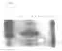 Fig. 10 - Engineered listeria and methods of use thereof