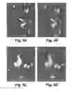 Fig. 06 - Vaccine