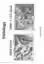 Fig. 11 - Bone void fillers