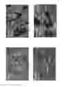 Fig. 14 - Bone void fillers