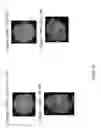 Fig. 18 - Bone void fillers