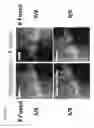 Fig. 19 - Bone void fillers