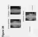 Fig. 22 - Bone void fillers