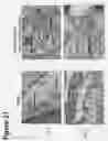 Fig. 23 - Bone void fillers
