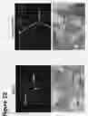 Fig. 25 - Bone void fillers