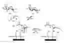 Fig. 01 - Particles that disrupt or impede bacterial adhesion, related compositions and methods