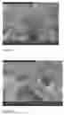 Fig. 02 -  Coating Comprising A Poly(Ethylene Glycol)-Poly(Lactide-Glycolide-Caprolactone) Interpenetrating Network