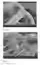 Fig. 03 -  Coating Comprising A Poly(Ethylene Glycol)-Poly(Lactide-Glycolide-Caprolactone) Interpenetrating Network
